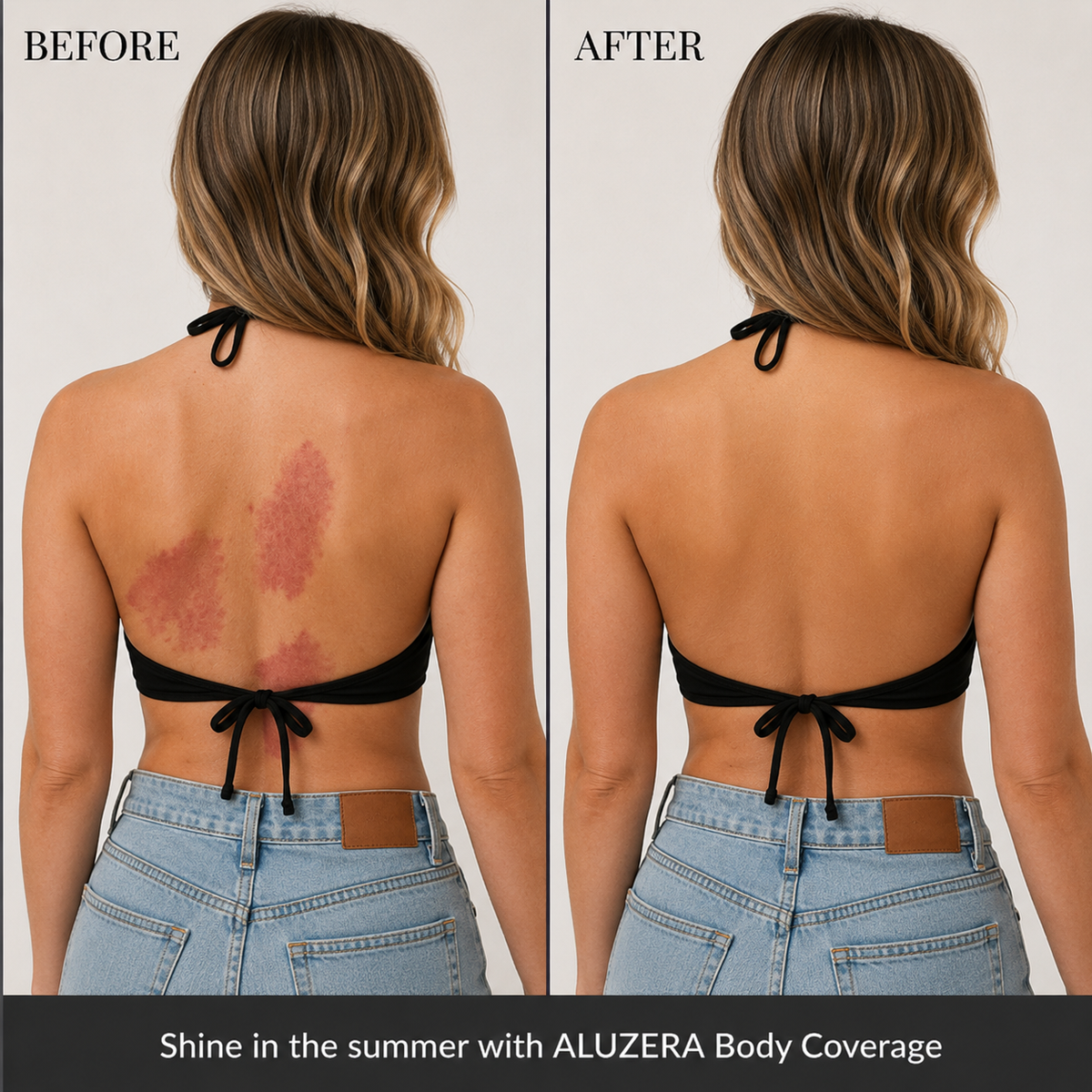 Before and after using Aluzera Body Coverage Concealer to cover skin marks
